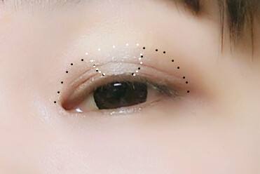 整形專家李長賦做雙眼皮效果好不好？