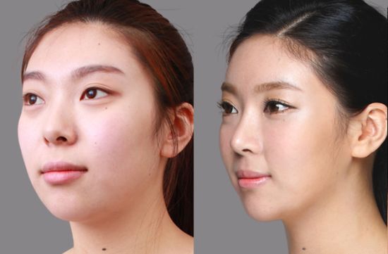 鄭州隆鼻和鼻修復(fù)專家有哪些？哪個(gè)專家更好呢？