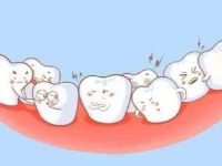 虎牙是什么?虎牙必須要拔掉嗎?虎牙矯正的方法有哪些?