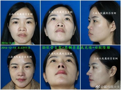 上海九院戴傳昌、王濤、魏皎、陳付國、蘇薇潔擅長哪些項目？