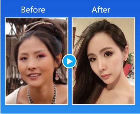 廈門哪位醫生擅長做肋軟骨隆鼻？