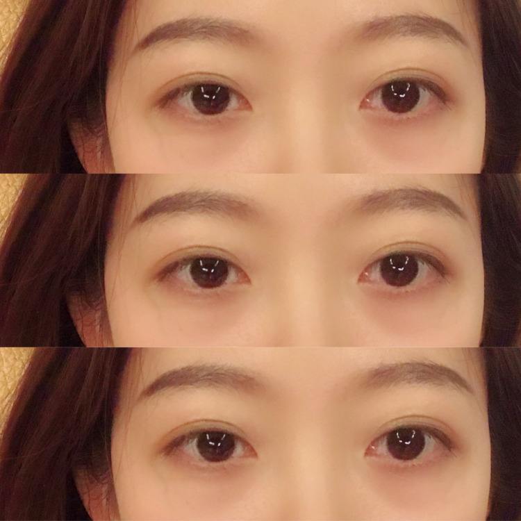 北京知名雙眼皮醫(yī)生和雙眼皮修復(fù)專家都有哪些？