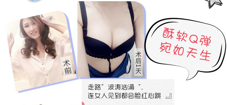 王世虎豐胸案例