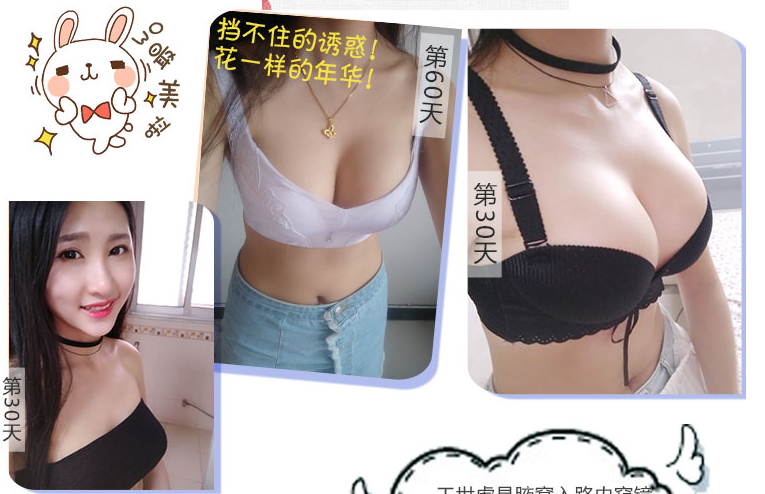 王世虎豐胸案例