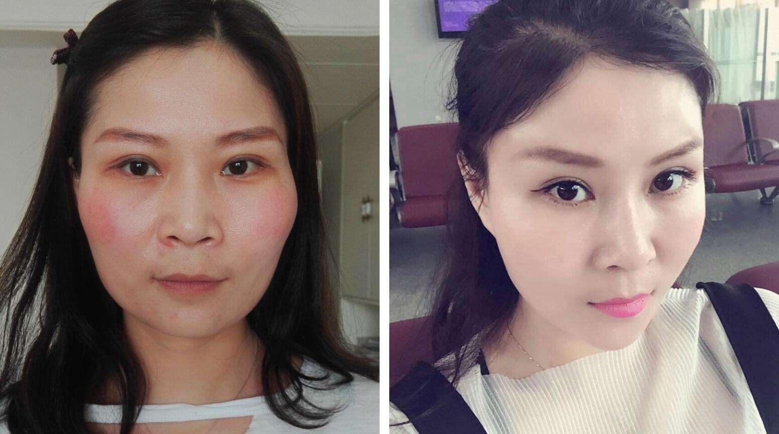 上海做面部填充哪個醫(yī)生最厲害？大概多少錢？