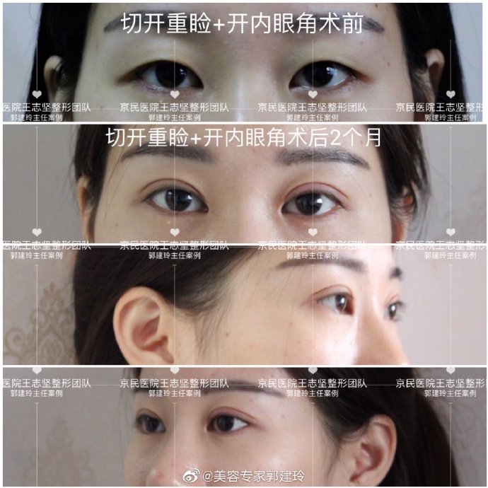 眼綜合案例
