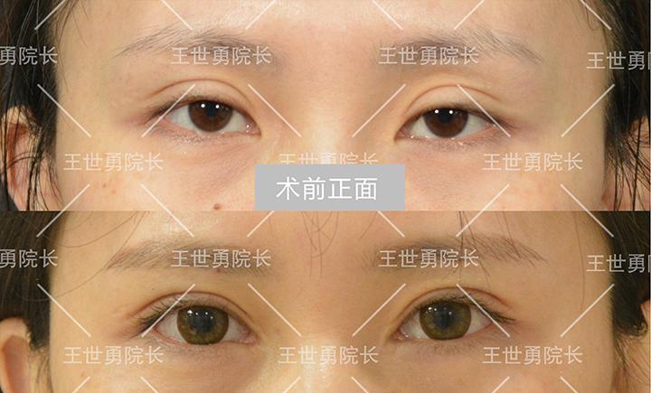 國(guó)內(nèi)知名度較高雙眼皮修復(fù)專家都有哪些？