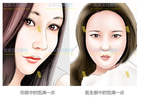 北京艾瑪韋元強和上海九院曹衛剛面部脂肪修復誰好？