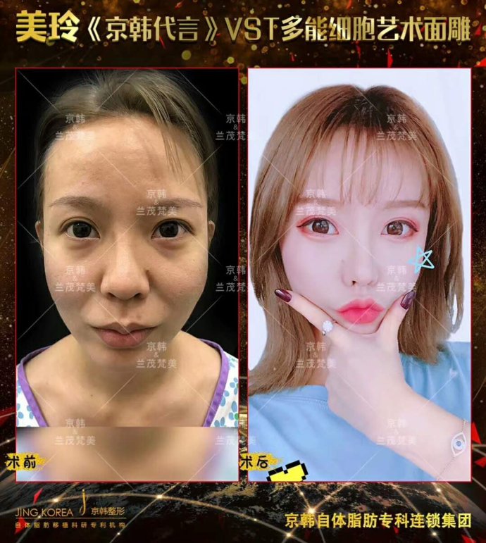 喬愛(ài)軍面部精雕案例