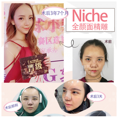 喬愛(ài)軍面部精雕