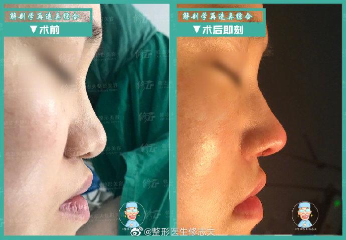 廈門修志夫技術(shù)好不好?想找他做鼻子。