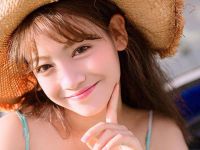 割雙眼皮術后兩眼不對稱怎么辦？兩眼不對稱修復案例詳解