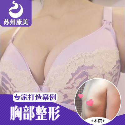 劉道功豐胸案例