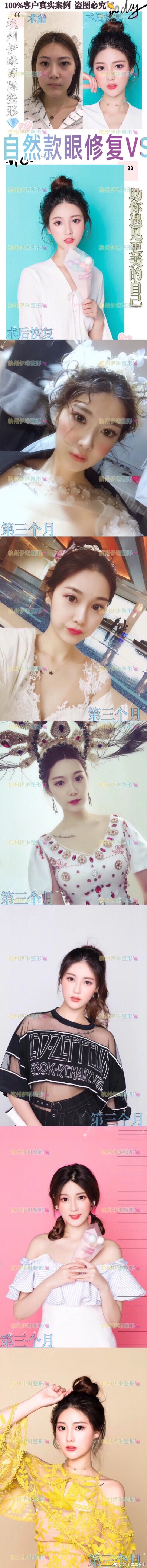 毛琪眼修復(fù)案例