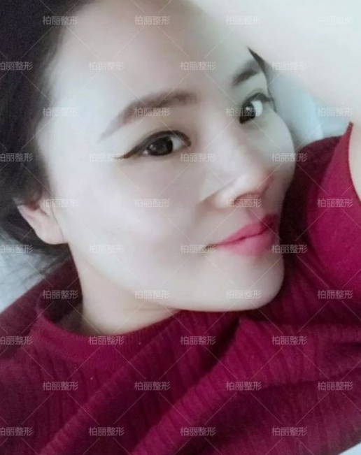 高難度鼻修復案例