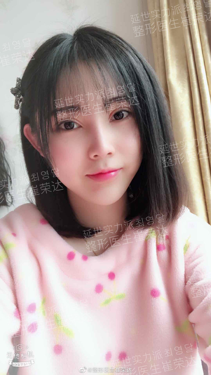 崔榮達磨骨案例