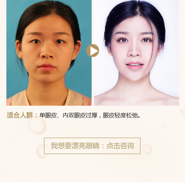 美杜莎眼綜合