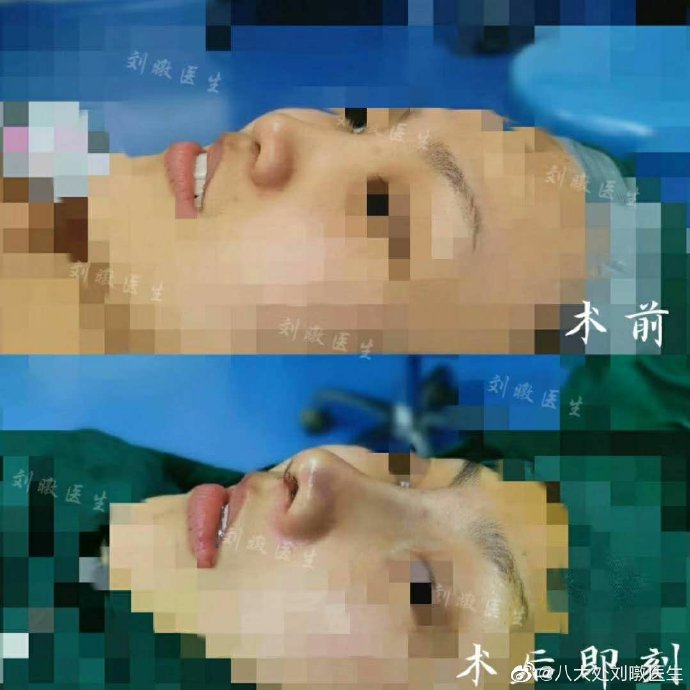 劉暾案例