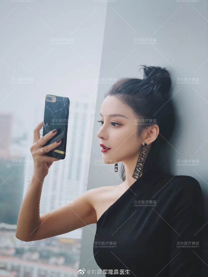 劉彥軍隆鼻案例