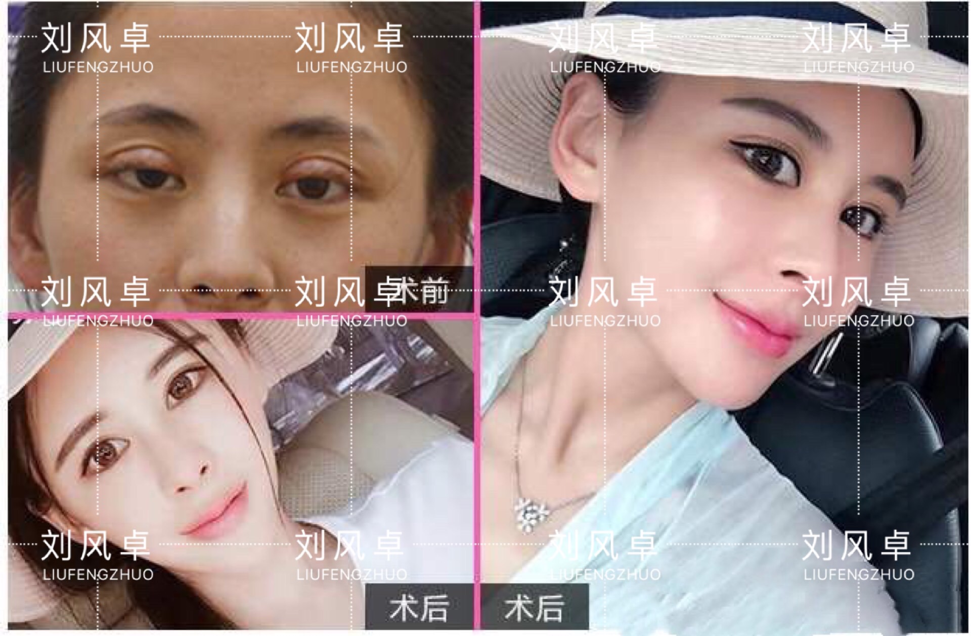劉風卓案例