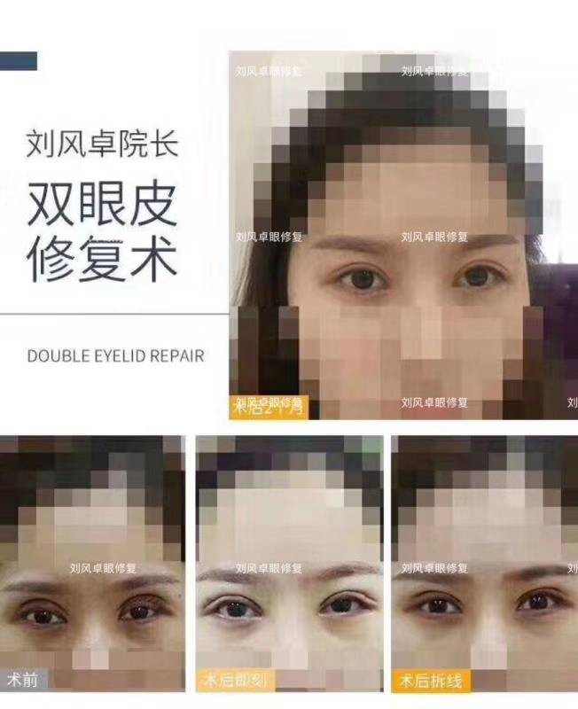 劉風卓案例
