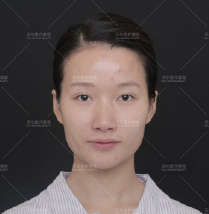 劉彥軍鼻修復案例