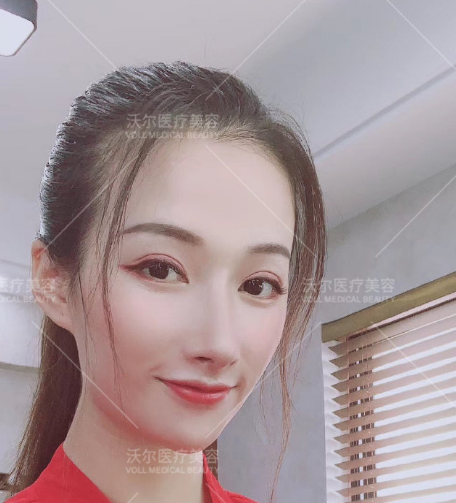 劉彥軍鼻修復案例