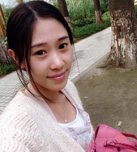 孫寶姍面部填充