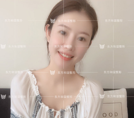 馮斌面部填充案例