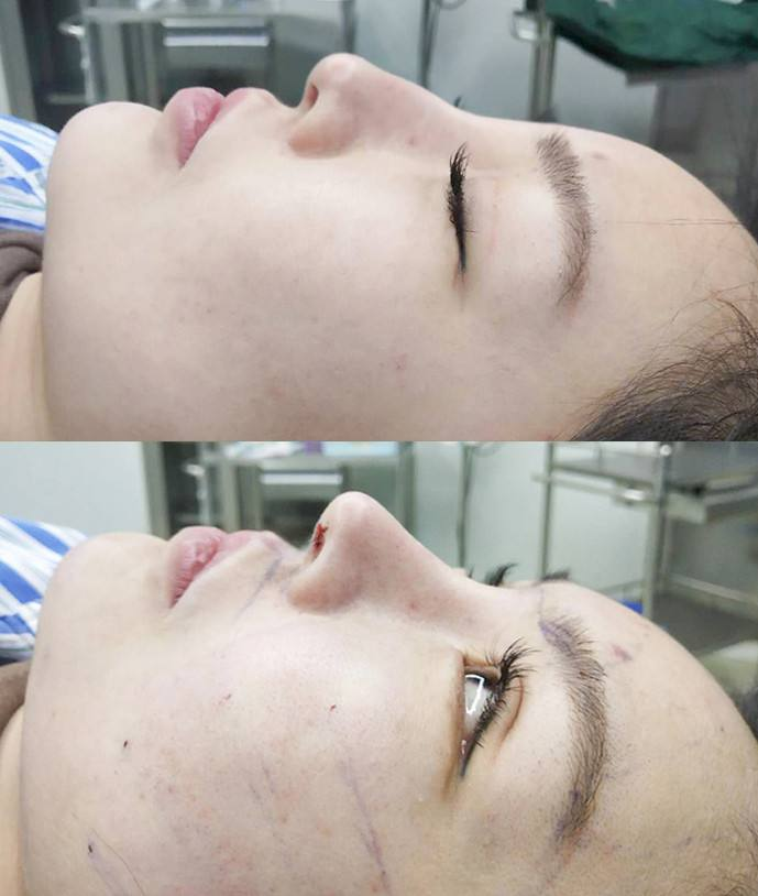 國內最好的鼻子修復專家是誰，誰最厲害！