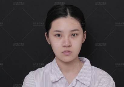 劉彥軍鼻修復(fù)案例