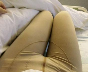 大腿吸脂八大處馬桂娥和顧云鵬哪個技術(shù)好？