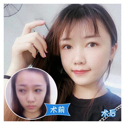 廣州脂肪填充最好的醫(yī)生是哪位？