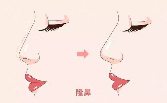 廣州鼻綜合最好的醫(yī)院是哪個(gè)？