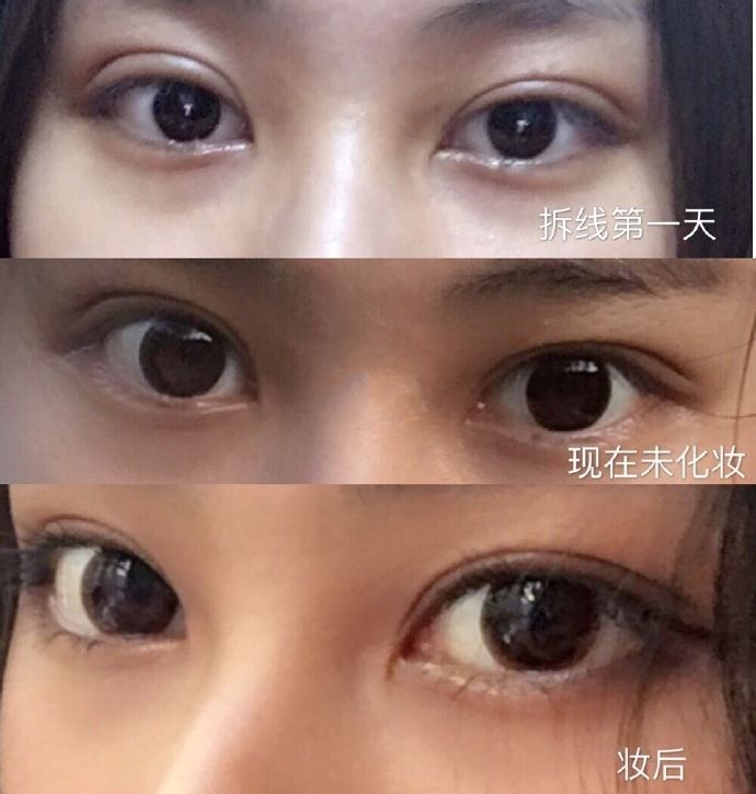 上海九院眼睛修復專家排名