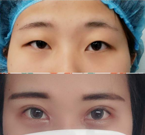上海三甲醫院眼綜合哪個醫生做的好？
