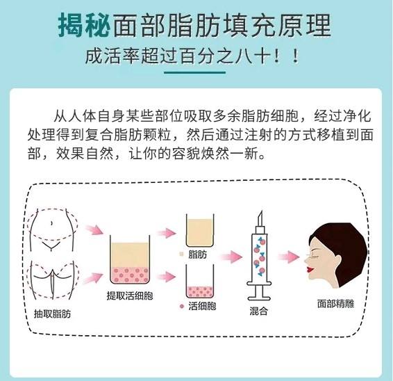 北京做面部充填最好的醫生