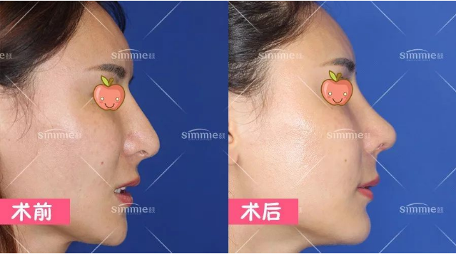 深圳鼻修復專家有哪些？