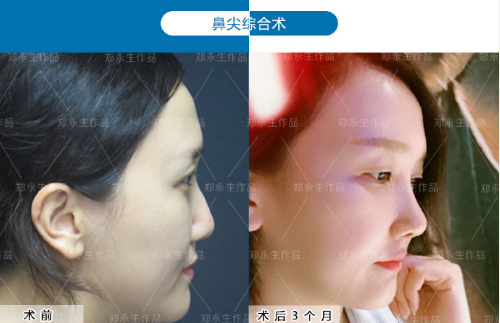 鄭永生案例