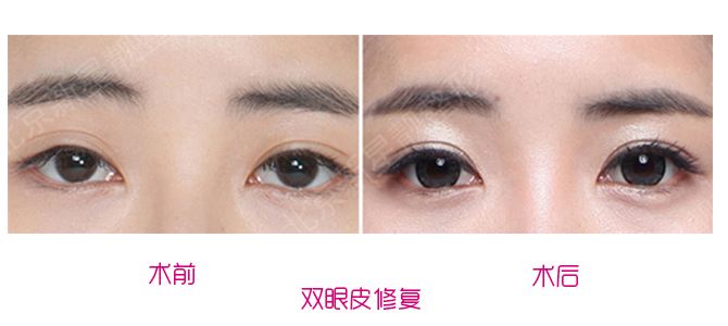 中國眼修復(fù)專家劉風(fēng)卓和王振軍哪個更厲害？