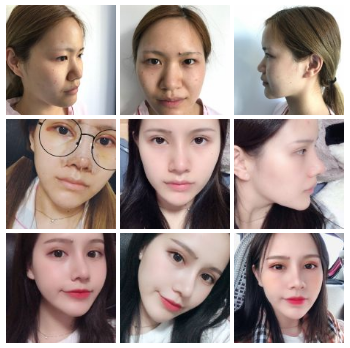 國內排名前十隆鼻專家