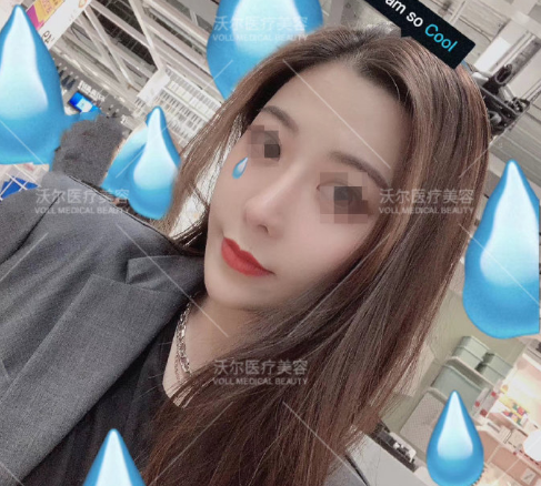 劉彥軍肋骨鼻案例