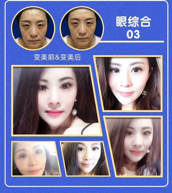 廣州眼綜合最權威專家都有哪些?