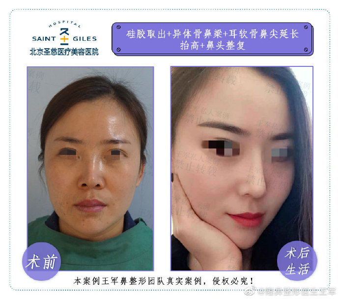 國內最好的鼻子修復專家是誰？
