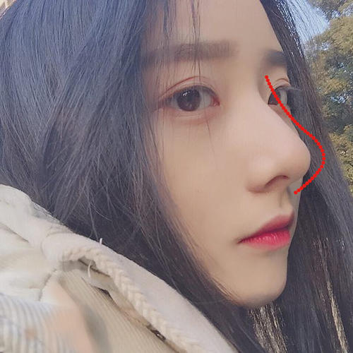 成都鼻綜合出名的醫(yī)生是哪個？