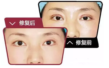 石家莊眼修復(fù)專家都有哪些?