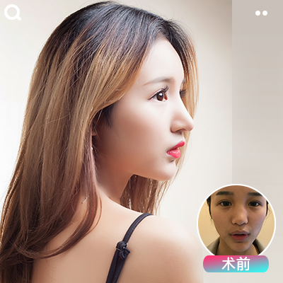 重慶鼻綜合哪個(gè)醫(yī)生最好?2020年重慶鼻綜合的醫(yī)生排名