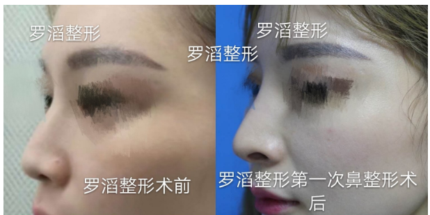 2020年長沙鼻綜合的醫生排名