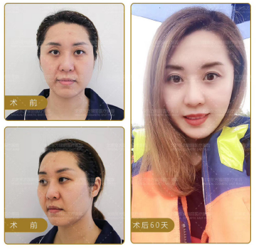 國內面部提升最好專家排名
