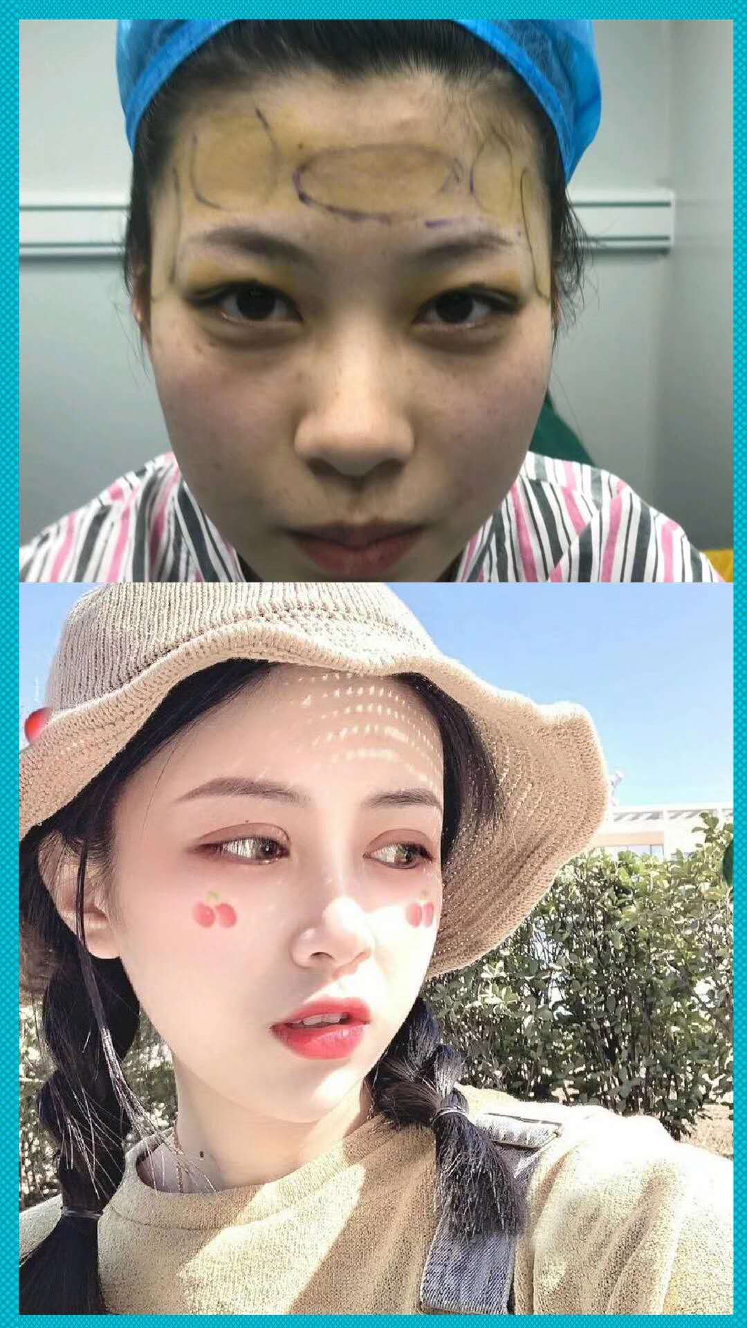 全國最好的脂肪填充專家